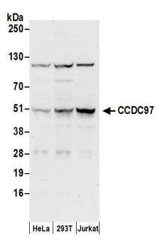 CCDC97 Antibody - Detection of human CCDC97 by western blot. Samples: Whole cell lysate (50 µg) from HeLa, HEK293T, and Jurkat cells prepared using NETN lysis buffer. Antibodies: Affinity purified rabbit anti-CCDC97 antibody used for WB at 0.1 µg/ml. Detection: Chemiluminescence with an exposure time of 30 seconds.