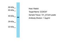 CCDC97 Antibody -  This image was taken for the unconjugated form of this product. Other forms have not been tested.