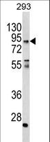 CCHCR1 Antibody - Western blot of CCHCR1 Antibody in 293 cell line lysates (35 ug/lane). CCHCR1 (arrow) was detected using the purified antibody.