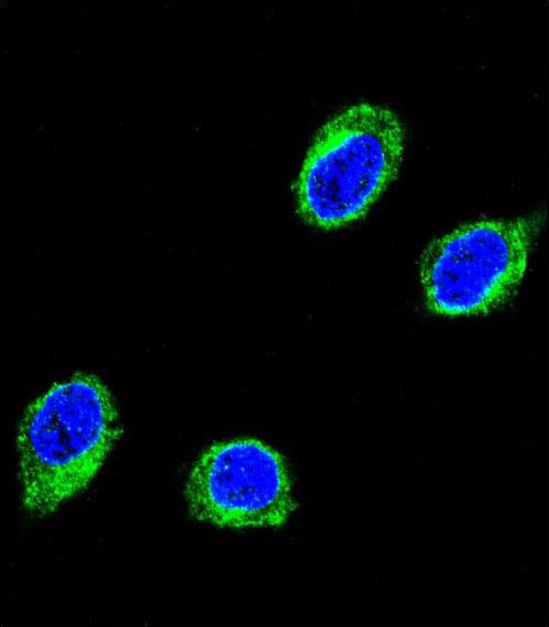 CCHCR1 Antibody - Confocal immunofluorescence of CCHCR1 Antibody with 293 cell followed by Alexa Fluor 488-conjugated goat anti-rabbit lgG (green).DAPI was used to stain the cell nuclear (blue).