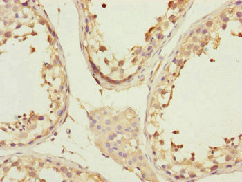 CCHCR1 Antibody - Immunohistochemistry of paraffin-embedded human testis tissue at dilution of 1:100
