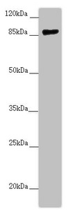 CCHCR1 Antibody - Western blot All Lanes:CCHCR1 antibody at 2.67 ug/ml+ 293T whole cell lysate Secondary Goat polyclonal to rabbit IgG at 1/10000 dilution Predicted band size: 89,100,96 kDa Observed band size: 89 kDa