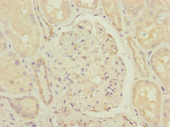 CCHCR1 Antibody - Immunohistochemistry of paraffin-embedded human testis tissue at dilution of 1:100