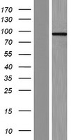 CCHCR1 Protein - Western validation with an anti-DDK antibody * L: Control HEK293 lysate R: Over-expression lysate