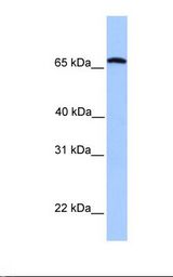 CCIN / Calicin Antibody - Fetal liver lysate. Antibody concentration: 1.0 ug/ml. Gel concentration: 12%.  This image was taken for the unconjugated form of this product. Other forms have not been tested.