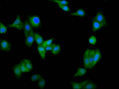 CCIN / Calicin Antibody - Immunofluorescence staining of HepG2 cells diluted at 1:66, counter-stained with DAPI. The cells were fixed in 4% formaldehyde, permeabilized using 0.2% Triton X-100 and blocked in 10% normal Goat Serum. The cells were then incubated with the antibody overnight at 4°C.The Secondary antibody was Alexa Fluor 488-congugated AffiniPure Goat Anti-Rabbit IgG (H+L).