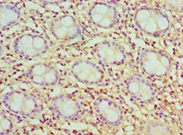 CCK / Cholecystokinin Antibody - Immunohistochemistry of paraffin-embedded human rectum tissue using antibody at 1:100 dilution.