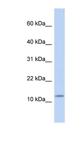 CCK / Cholecystokinin Antibody - CCK / Cholecystokinin antibody Western blot of Fetal Brain lysate. This image was taken for the unconjugated form of this product. Other forms have not been tested.