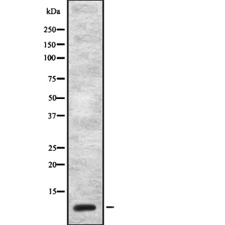 CCK / Cholecystokinin Antibody - Western blot analysis of CCK using NIH-3T3 whole cells lysates