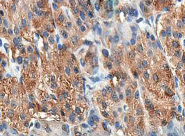 CCK / Cholecystokinin Antibody - 1:200 staining human pancreas tissue by IHC-P. The tissue was formaldehyde fixed and a heat mediated antigen retrieval step in citrate buffer was performed. The tissue was then blocked and incubated with the antibody for 1.5 hours at 22°C. An HRP conjugated goat anti-rabbit antibody was used as the secondary.