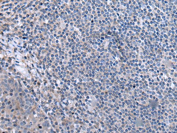 CCK / Cholecystokinin Antibody - Immunohistochemistry of paraffin-embedded Human tonsil tissue  using CCK Polyclonal Antibody at dilution of 1:55. (Original magnific at ion: ×200) at dilution of 1:55(×200)