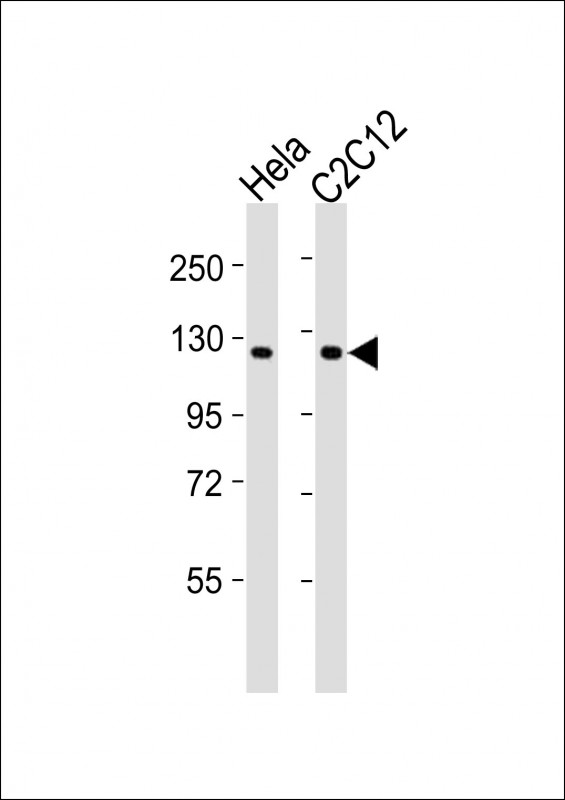 CCK4 / PTK7 Antibody - All lanes : Anti-PTK7 Antibody at 1:2000 dilution Lane 1: HeLa whole cell lysates Lane 2: C2C12 whole cell lysates Lysates/proteins at 20 ug per lane. Secondary Goat Anti-Rabbit IgG, (H+L), Peroxidase conjugated at 1/10000 dilution Predicted band size : 118 kDa Blocking/Dilution buffer: 5% NFDM/TBST.