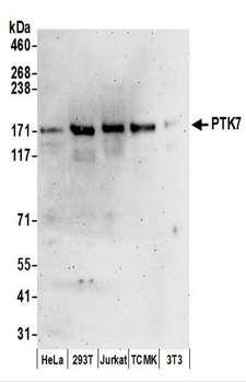 CCK4 / PTK7 Antibody - Detection of Human and Mouse PTK7 by Western Blot. Samples: Whole cell lysate (50 ug) prepared using NETN buffer from HeLa, 293T, Jurkat, mouse TCMK-1, and mouse NIH3T3 cells. Antibodies: Affinity purified rabbit anti-PTK7 antibody used for WB at 0.1 ug/ml. Detection: Chemiluminescence with an exposure time of 3 minutes.