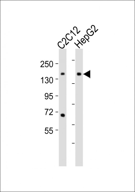 CCK4 / PTK7 Antibody - All lanes : Anti-Ptk7 Antibody at 1:2000 dilution Lane 1: C2C12 whole cell lysates Lane 2: HepG2 whole cell lysates Lysates/proteins at 20 ug per lane. Secondary Goat Anti-Rabbit IgG, (H+L), Peroxidase conjugated at 1/10000 dilution Predicted band size : 118 kDa Blocking/Dilution buffer: 5% NFDM/TBST.