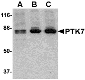 CCK4 / PTK7 Antibody - Western blot of PTK7 in (A) human, (B) mouse and (C) rat colon tissue lysate with PTK7 antibody at 1 ug/ml.