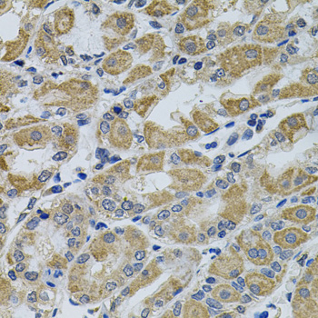 CCK4 / PTK7 Antibody - Immunohistochemistry of paraffin-embedded human stomach tissue.