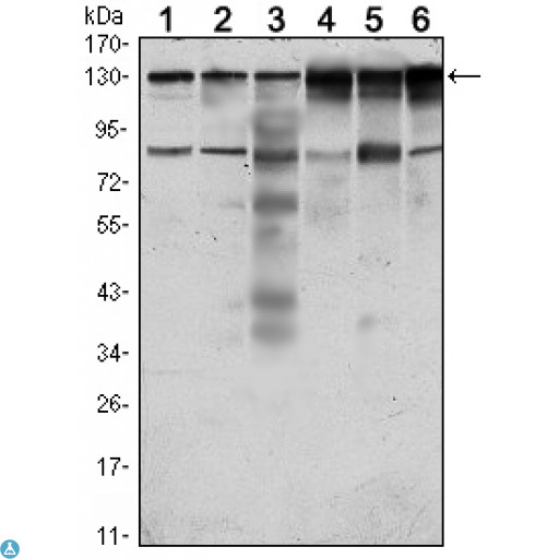 CCK4 / PTK7 Antibody - Western Blot (WB) analysis using CCK-4 Monoclonal Antibody against HeLa (1), A431 (2), HCT116 (3), Caco2 (4), HepG2 (5) and MCF-7 (6) cell lysate.