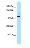 CCKAR / CCK1R Antibody - CCKAR / CCK-A Receptor antibody Western Blot of MCF7.  This image was taken for the unconjugated form of this product. Other forms have not been tested.