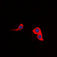 CCKAR / CCK1R Antibody - Immunofluorescent analysis of CCKAR staining in HeLa cells. Formalin-fixed cells were permeabilized with 0.1% Triton X-100 in TBS for 5-10 minutes and blocked with 3% BSA-PBS for 30 minutes at room temperature. Cells were probed with the primary antibody in 3% BSA-PBS and incubated overnight at 4 deg C in a humidified chamber. Cells were washed with PBST and incubated with a DyLight 594-conjugated secondary antibody (red) in PBS at room temperature in the dark. DAPI was used to stain the cell nuclei (blue).