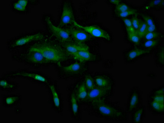 CCKAR / CCK1R Antibody - Immunofluorescence staining of Hela cells at a dilution of 1:133, counter-stained with DAPI. The cells were fixed in 4% formaldehyde, permeabilized using 0.2% Triton X-100 and blocked in 10% normal Goat Serum. The cells were then incubated with the antibody overnight at 4 °C.The secondary antibody was Alexa Fluor 488-congugated AffiniPure Goat Anti-Rabbit IgG (H+L) .