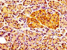 CCKAR / CCK1R Antibody - Immunohistochemistry image at a dilution of 1:100 and staining in paraffin-embedded human pancreatic tissue performed on a Leica BondTM system. After dewaxing and hydration, antigen retrieval was mediated by high pressure in a citrate buffer (pH 6.0) . Section was blocked with 10% normal goat serum 30min at RT. Then primary antibody (1% BSA) was incubated at 4 °C overnight. The primary is detected by a biotinylated secondary antibody and visualized using an HRP conjugated SP system.