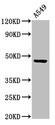 CCKAR / CCK1R Antibody - Positive Western Blot detected in A549 whole cell lysate. All lanes: CCKAR antibody at 3.4 µg/ml Secondary Goat polyclonal to rabbit IgG at 1/50000 dilution. Predicted band size: 48 KDa. Observed band size: 48 KDa