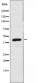 CCKAR / CCK1R Antibody - Western blot analysis of extracts of HuvEc cells using CCKAR antibody.