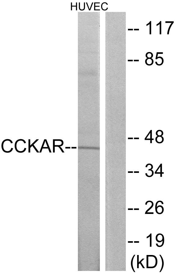 CCKAR / CCK1R Antibody - Western blot analysis of extracts from HUVEC cells, using CCKAR antibody.