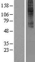 CCKAR / CCK1R Protein - Western validation with an anti-DDK antibody * L: Control HEK293 lysate R: Over-expression lysate