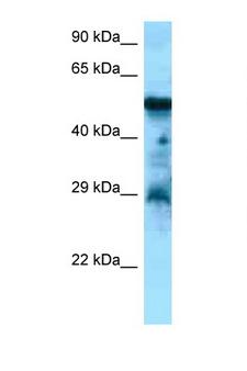 CCKBR / Cckb Antibody - CCKBR antibody Western blot of Placenta lysate. Antibody concentration 1 ug/ml.  This image was taken for the unconjugated form of this product. Other forms have not been tested.