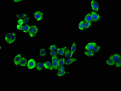 CCKBR / Cckb Antibody - Immunofluorescence staining of PC-3 cells with CCKBR Antibody at 1:133, counter-stained with DAPI. The cells were fixed in 4% formaldehyde, permeabilized using 0.2% Triton X-100 and blocked in 10% normal Goat Serum. The cells were then incubated with the antibody overnight at 4°C. The secondary antibody was Alexa Fluor 488-congugated AffiniPure Goat Anti-Rabbit IgG(H+L).