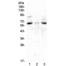 CCKBR / Cckb Antibody - Western blot testing of 1) rat brain, 2) rat stomach and 3) mouse brain lysate with CCKBR antibody at 0.5ug/ml. Predicted molecular weight ~48 kDa, but can be observed at 68-97 kDa.