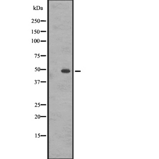 CCKBR / Cckb Antibody - Western blot analysis of GASR expression in A431 whole cells lysate. The lane on the left is treated with the antigen-specific peptide.
