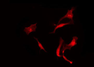 CCKBR / Cckb Antibody - Staining A549 cells by IF/ICC. The samples were fixed with PFA and permeabilized in 0.1% Triton X-100, then blocked in 10% serum for 45 min at 25°C. The primary antibody was diluted at 1:200 and incubated with the sample for 1 hour at 37°C. An Alexa Fluor 594 conjugated goat anti-rabbit IgG (H+L) Ab, diluted at 1/600, was used as the secondary antibody.