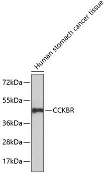 CCKBR / Cckb Antibody - Western blot analysis of extracts of human stomach cancer tissue using CCKBR Polyclonal Antibody.