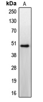 CCKBR / Cckb Antibody - Western blot analysis of CCKBR expression in HeLa (A) whole cell lysates.