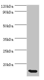 CCL11 / Eotaxin Antibody - Western blot All lanes: CCL11 antibody at 5µg/ml + Hela whole cell lysate Secondary Goat polyclonal to rabbit IgG at 1/10000 dilution Predicted band size: 11 kDa Observed band size: 11 kDa