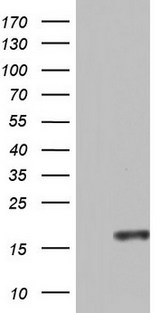 CCL11 / Eotaxin Antibody - HEK293T cells were transfected with the pCMV6-ENTRY control (Left lane) or pCMV6-ENTRY CCL11 (Right lane) cDNA for 48 hrs and lysed. Equivalent amounts of cell lysates (5 ug per lane) were separated by SDS-PAGE and immunoblotted with anti-CCL11.