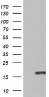 CCL11 / Eotaxin Antibody - HEK293T cells were transfected with the pCMV6-ENTRY control (Left lane) or pCMV6-ENTRY CCL11 (Right lane) cDNA for 48 hrs and lysed. Equivalent amounts of cell lysates (5 ug per lane) were separated by SDS-PAGE and immunoblotted with anti-CCL11.