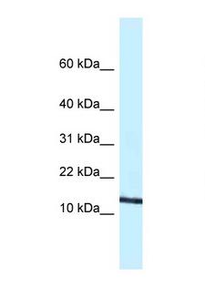 CCL11 / Eotaxin Antibody - CCL11 / Eotaxin antibody Western blot of Mouse Spleen lysate. Antibody concentration 1 ug/ml.  This image was taken for the unconjugated form of this product. Other forms have not been tested.