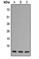 CCL11 / Eotaxin Antibody - Western blot analysis of CCL11 expression in HeLa (A); Raw264.7 (B); PC12 (C) whole cell lysates.