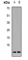 CCL11 / Eotaxin Antibody - Western blot analysis of CCL11 expression in HepG2 (A); mouse muscle (B) whole cell lysates.