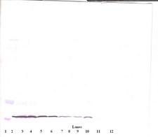 CCL11 / Eotaxin Antibody - Anti-Human Eotaxin (CCL11) Western Blot Unreduced