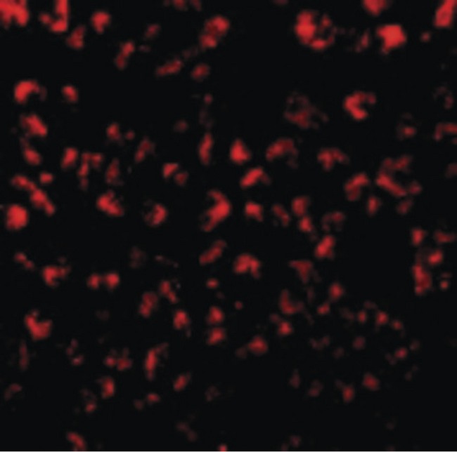 CCL11 / Eotaxin Antibody - Immunofluorescence of Eotaxin in 293 cells with Eotaxin antibody at 10 ug/ml.