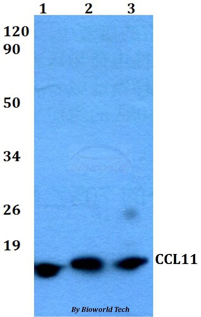 CCL11 / Eotaxin Antibody - Western blot of CCL11 antibody at 1:500 dilution. Lane 1: HeLa whole cell lysate. Lane 2: Raw264.7 whole cell lysate. Lane 3: PC12 whole cell lysate.