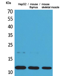 CCL11 / Eotaxin Antibody - Western Blot analysis of extracts from HepG2, mouse thymus, mouse skeletal muscle cells using CCL11 Antibody.