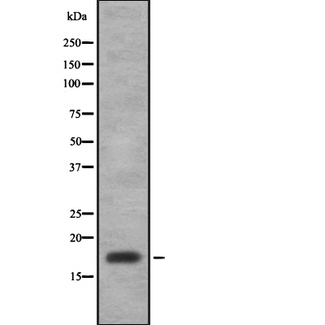 CCL11 / Eotaxin Antibody - Western blot analysis of CCL11 using lung whole tissue lysates