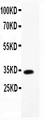 CCL13 / MCP4 Antibody - Western blot - Anti-CCL13/MCP4 Antibody