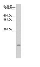 CCL13 / MCP4 Antibody - Transfected 293T Cell Lysate.  This image was taken for the unconjugated form of this product. Other forms have not been tested.