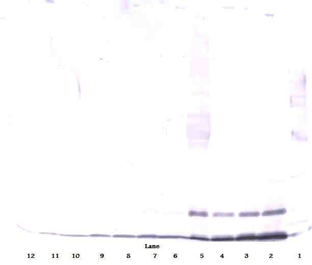 CCL13 / MCP4 Antibody - Anti-Human MCP-4 (CCL13) Western Blot Reduced